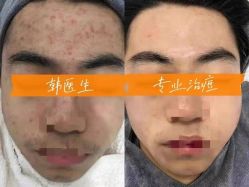 -瓷肌博士·祛痘科技美肤