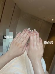 点击看大图 -AURAS璈然科技护肤中心
