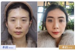 -圣嘉新医疗美容医院