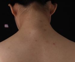 -厦门美莱整形美容医院