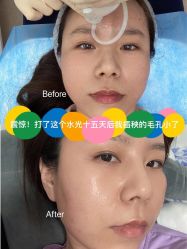 -亿美医疗美容·半岛大超炮官方授权店