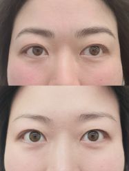 -西施无菌半永久纹绣眉眼影唇轻增发纹发际线