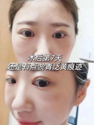-天津健丽·去眼袋医疗美容机构