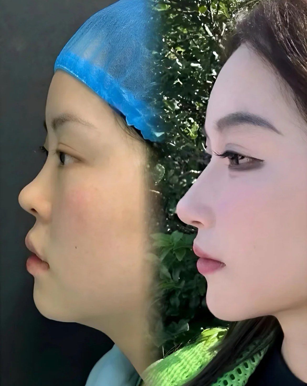 小翘鼻真的是太美了!