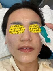 -More摩尔医美の注射线雕光电中心