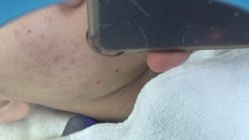 -金品苗方专业祛痘中心