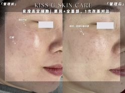 -KISS U 国际美学