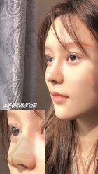 -北京米扬丽格医疗美容·联合丽格鼻整形中心