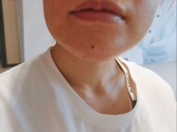 -广东韩妃整形外科医院