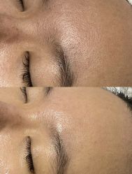 -美愈美肤MEIYU SKIN