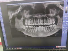 -上海市杨浦区牙病防治所