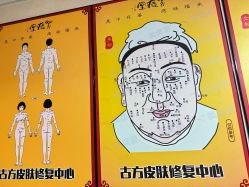 -北京美痣堂古方祛痣斑疣瘊