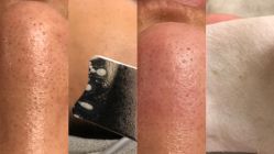 -慈蕊美容养生·专业经络调理