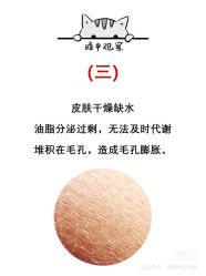 -凡碧诗毛孔清洁收细