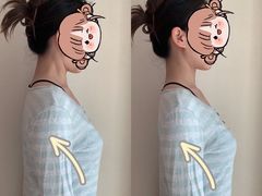 -FACE·日本小颜美容整骨(福田店)
