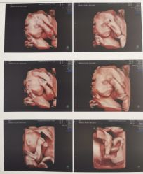 -杭州贝瑞斯美华妇儿医院·早孕·产检·儿科