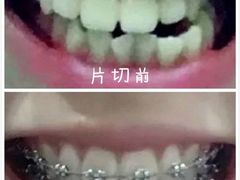 -团圆口腔·种植中心(锦江院区)