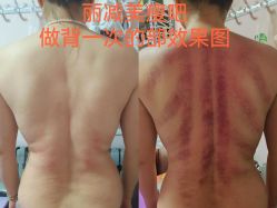 -丽减美瘦吧·减肥瘦身