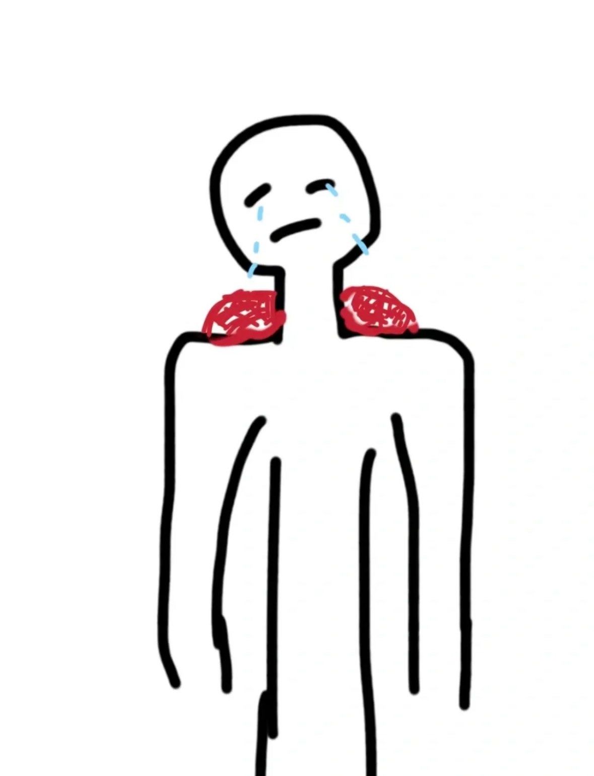 整个肩膀区域会出现僵硬的情况,很多人还会伴随着探颈