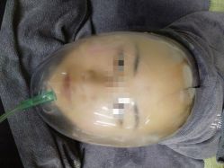 -苗方清颜·祛痘皮肤管理
