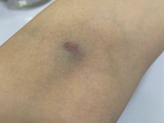 -东南大学附属中大医院(本部)