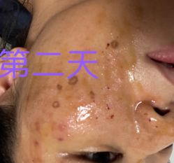 体验后-广州美莱医疗美容医院