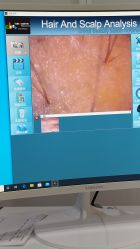 -雍禾植发全国连锁