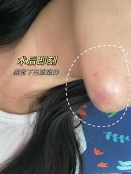 -广州美莱医疗美容医院