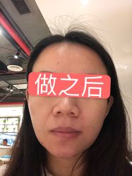 -深圳鹏爱悦心医疗美容医院