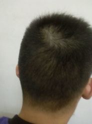 android_upload_pic-FG HAIR·烫发·染发