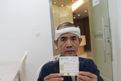 -大麦微针植发丨全国连锁