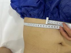 -摩瘦纤体订制减肥