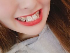 -极光口腔·矫正种植修复(锦江店)