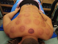 -悦艾堂·中医拔罐减肥·美体艾灸连锁