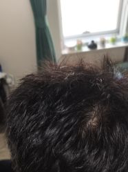-极客侠男士假发定制补发