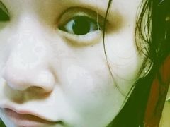 拆线后，也就是第十一天可以碰水-上海华安整形外科门诊部