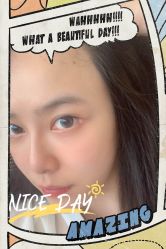 点击看大图 -大麦微针植发全国连锁