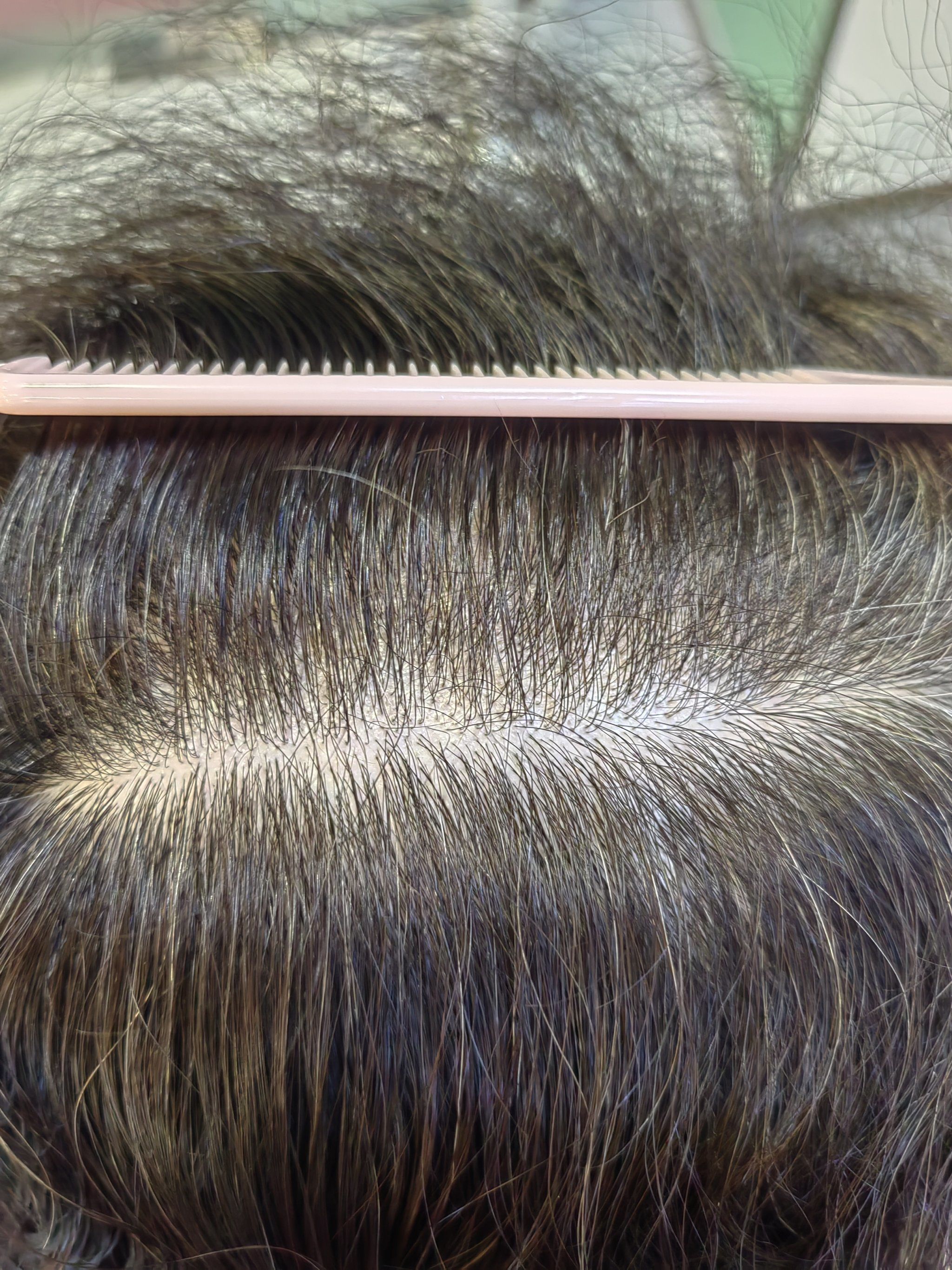 清爽型的头皮,你们喜气么