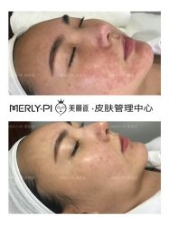 -MLP美丽派·问题肌疗愈中心