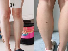 -浙江大学医学院附属第一医院(庆春院区)