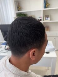 -大麦微针植发丨全国连锁