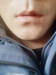 -聚美荟科技护肤