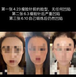 -纯粹医美