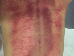 -正清和·推拿养生(黑石礁中心店)