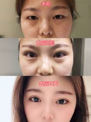 -长沙雅美医疗美容医院
