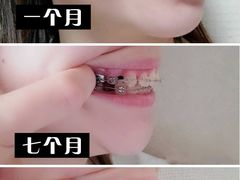 -极光口腔·矫正种植修复(锦江店)