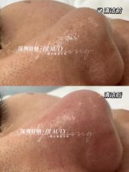 点击看大图 -DMK酶疗中心·BeautyYoung舒妍科技美肤