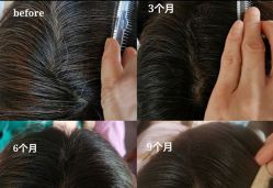 -舒欣头疗·俏丝谧语 白发脱发专业护理 