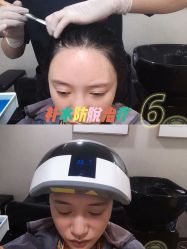 -熙朵美学植发连锁