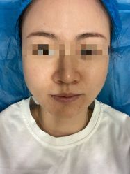 体验前-美瑞莎创美医疗美容